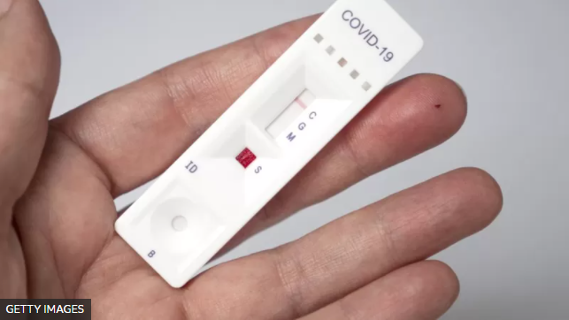  Testes rápidos da COVID-19 são inclusos na lista obrigatória dos planos de saúde